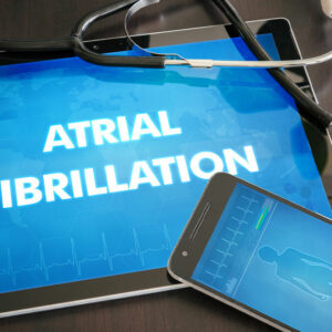 Atrial Fibrillation – Causes, Signs, and Remedies
