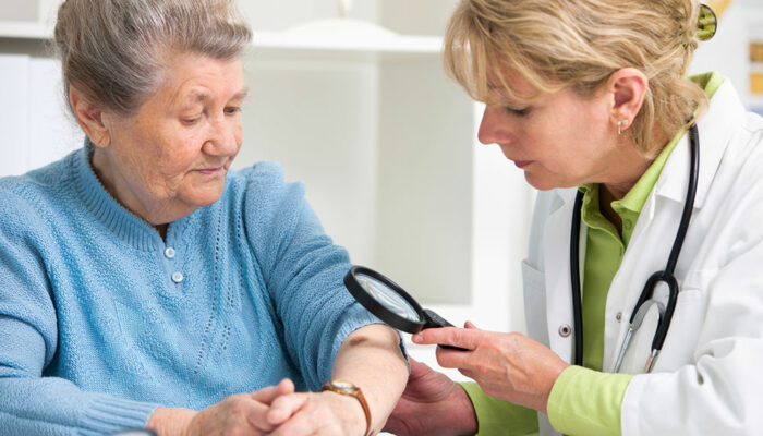 11 silent signs of skin cancer